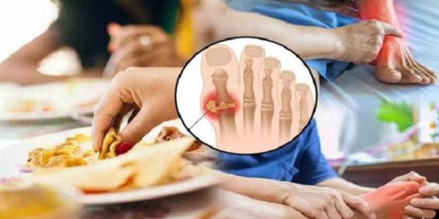 حمض اليوريك أطعمة ومشروبات تزيد من مخاطره - هرم مصر