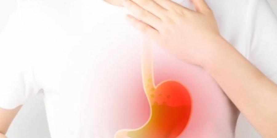 دون أدوية.. مشروبات لعلاج الحموضة وتهدئة المعدة - هرم مصر
