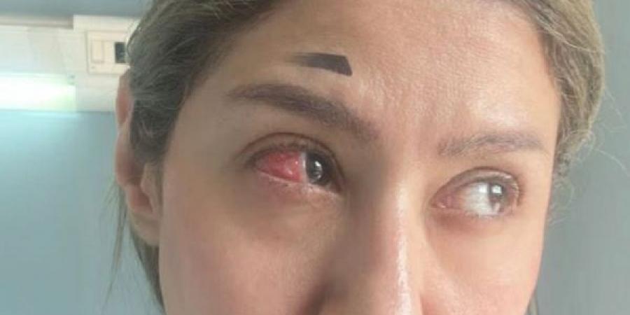  إيناس عز الدين تخضع لعملية جراحية فى العين - هرم مصر