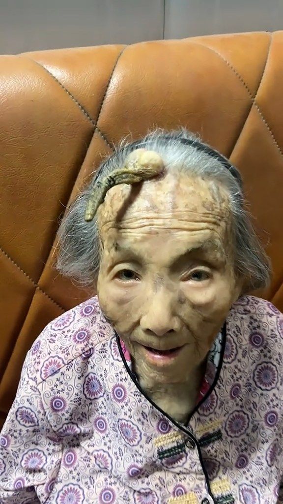 A 107-year-old woman from China has stunned social media users by showing off a huge horn growing out of her forehead — and many believe the bizarre growth is behind her remarkable longevity.