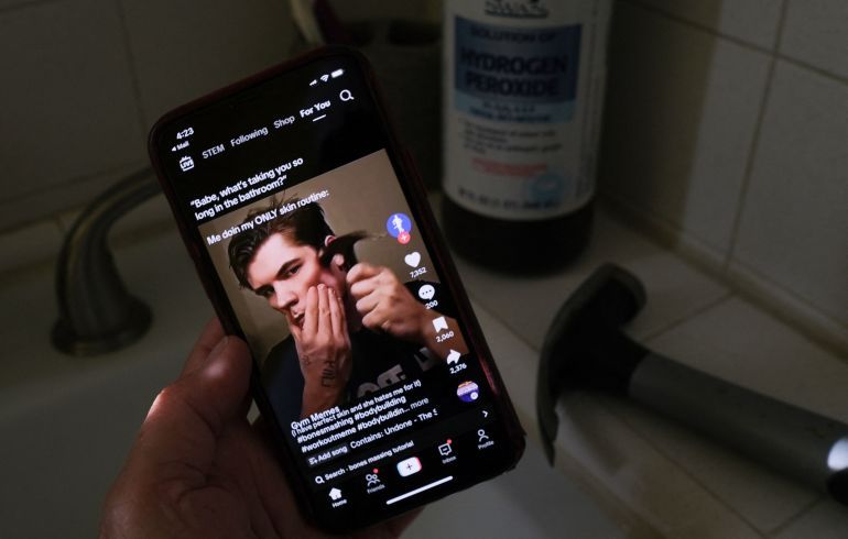 This illustration photo shows a video of male TikTok influencer hammering his cheekbone, playing on a smartphone in a bathroom next to a bottle of hydrogen peroxide and a hammer in Los Angeles, April 11, 2025. Hankering for a perfectly angular jaw, a male TikTok influencer hits his cheekbones with a hammer -- part of the popular online looksmaxxing trend that promotes unproven and often dangerous techniques to boost sexual appeal. Looksmaxxing influencers -- part of an online ecosystem dubbed the