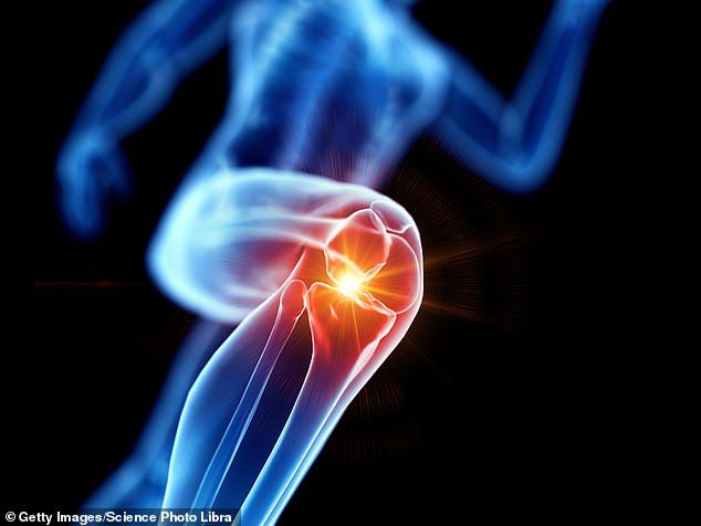 علاج التهاب المفاصل
