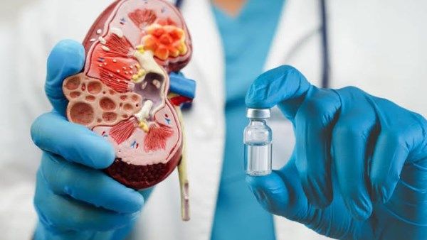 عادات بسيطة تقيك من الفشل الكلوي وفقًا لخبراء الصحة