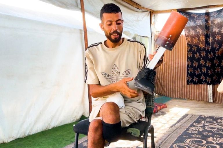 إبراهيم الغزي يصنع ساقا صناعية بنفسه بعد إصابته