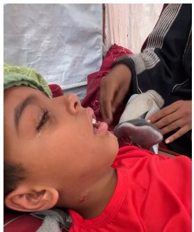 الطفل محمد ابو لولى الطفل محمد ابو لولى