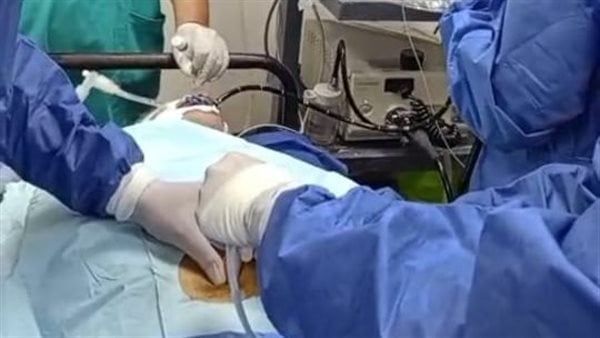 علاج الجلطات دون جراحة.. نقلة نوعية في مستشفى حميات منوف