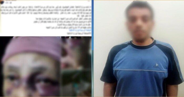 «خلافات مع زوجته».. القبض على المتهم بضرب «حماته» في شبرا الخيمة «خلافات مع زوجته».. القبض على المتهم بضرب «حماته» في شبرا الخيمة