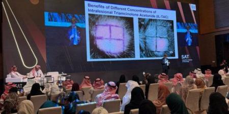 بمشاركة عالمية.. 750 طبيبًا يناقشون علاج تساقط الشعر في الرياض - هرم مصر