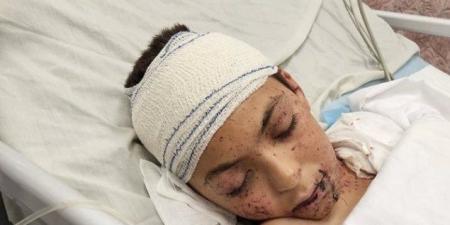 إيطاليا ستستقبل طفلًا فلسطينيًا نجا من القصف الإسرائيلي الأسبوع المقبل - هرم مصر