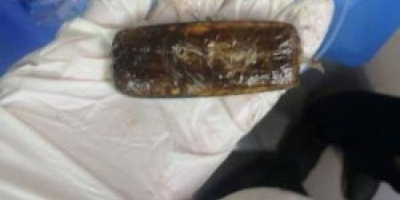 في واقعة نادرة.. استخراج هاتف محمول من بطن شاب مصري بعد عامين من ابتلاعه - هرم مصر