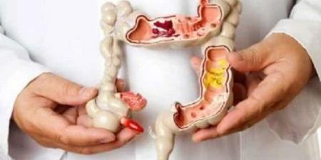 خطوة بسيطة قد تنقذك من سرطان الأمعاء #الصحة #منوعات #اخبار_الصحة #اخبار_منوعة #لايف_ستايل #الجمهورية_أون_لاين - هرم مصر