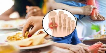 حمض اليوريك أطعمة ومشروبات تزيد من مخاطره - هرم مصر