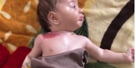 تلوث المياه بغزة يسبب التهابات نادرة لرضيعة عمرها 3 شهور تضعف مناعتها - هرم مصر