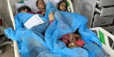 استشهاد 5 أشخاص بينهم طفلان نتيجة المجاعة وسوء التغذية فى غزة - هرم مصر