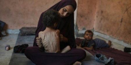 لسوء التغذية.. مصدر طبي في مستشفى الشفاء بغزة يعلن استشهاد الرضيعة رانيا غبن - هرم مصر