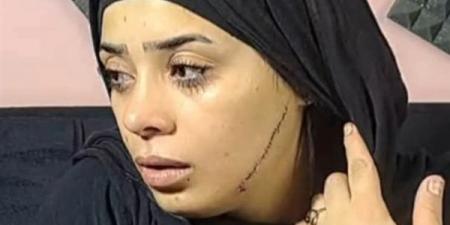 قرار عاجل بشأن المتهمة بتشويه وجه عروس طليقها بمصر القديمة - هرم مصر