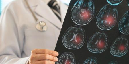 جهاز ثوري يعيد الكلام لمرضى السكتة الدماغية دون جراحة دماغية - جريدة هرم مصر