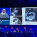 مصر تلمع في سماء الطب العالمي.. «شيرين عبد السلام» تمثل مستشفى الناس في أكبر مؤتمر دولي لعيوب القلب الهيكلية - هرم مصر