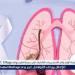 أول تجربة ناجحة لزراعة رئة من خنزير معدل وراثيًا لإنسان - هرم مصر