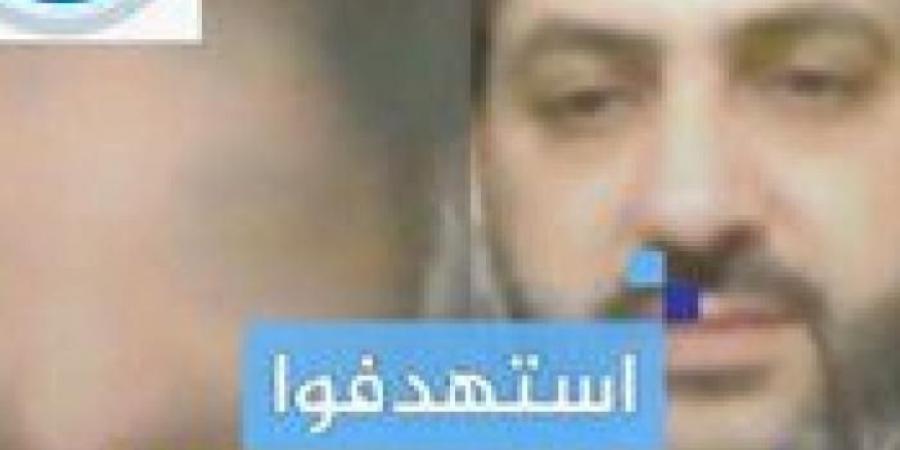 إصابة رئيس تحرير شبكة إعلامية خلال قصف إسرائيلي على الهواء "فيديو" - هرم مصر