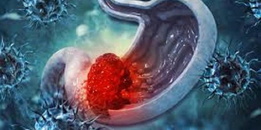 أدوية شائعة قد تؤدي إلى نتائج غير دقيقة لتحليل جرثومة المعدة #الصحة #منوعات #اخبار_الصحة #اخبار_منوعة #لايف_ستايل #الجمهورية_أون_لاين - هرم مصر