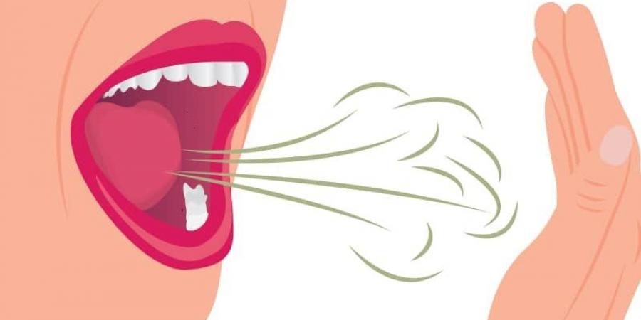العوامل المؤدية لرائحة الفم الكريهة وكيفية التعامل معها - هرم مصر