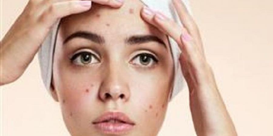 حمض الساليسيليك الحل السحري لمشاكل البشرة العنيدة - هرم مصر