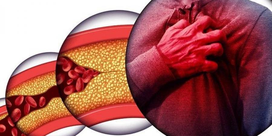 خطة غذائية تحمي القلب تخفض الكوليسترول الضار في 10 أيام فقط! #الصحة #منوعات #اخبار_الصحة #اخبار_منوعة #لايف_ستايل #الجمهورية_أون_لاين - هرم مصر