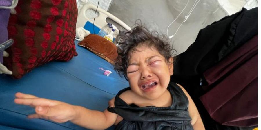 الطفلة حنين القصاص.. ضمور بالمخ يهدد حياتها مع استمرار الحرب فى غزة - هرم مصر
